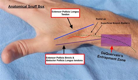 De Quervains Tenosynovitis Causes Symptoms Test Exercise Surgery