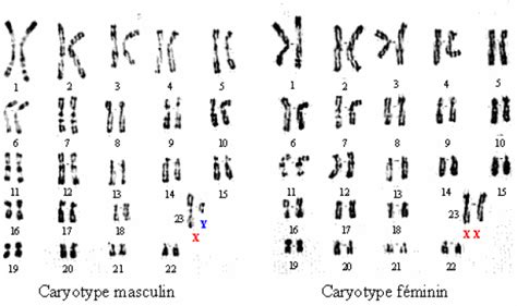 Exercice Analyse De Caryotypes