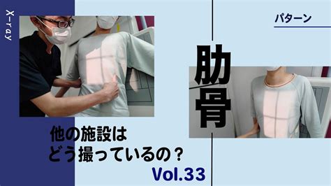 パターンを作ろう肋骨撮影法 正面撮影編 一般撮影レントゲン 他の施設はどう撮ってるのシリーズその33 YouTube