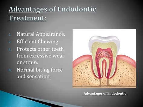 PPT Top 4 Reasons To Have An Endodontics Treatment Root Canals