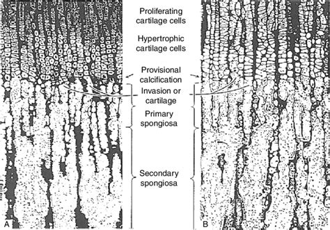 B 3 Endochondral Ossification In Longitudinal Sections Of The Zone Of Download Scientific