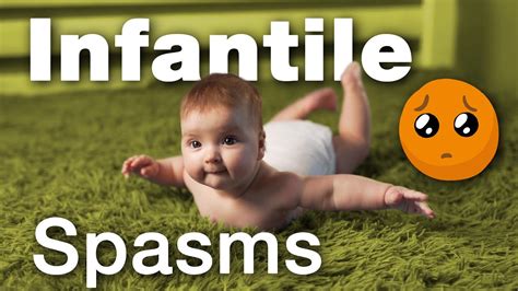 Recognizing Infantile Spasms Pediatricians Tips Aap