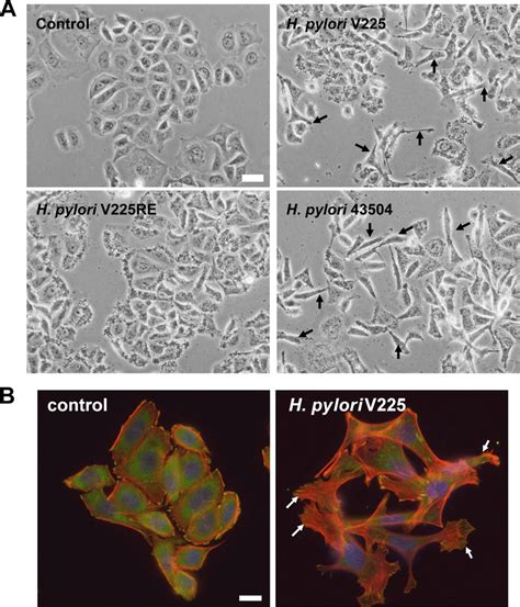 Helicobacter Pylori Strain V D Induces The Formation Of The