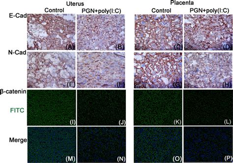 Loosening Of Adherens Junctions In Pgn Poly I C Treated Uterus And