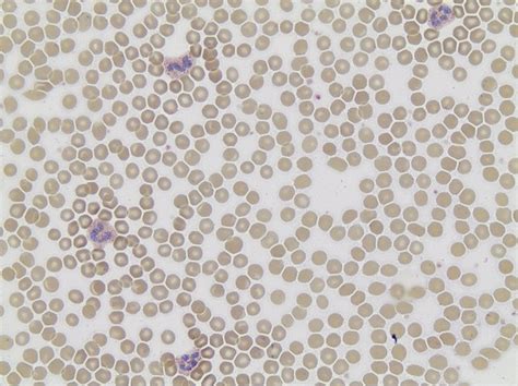 Acid Phosphatase Leukocyte T 387A 1KT SIGMA ALDRICH SLS Ireland