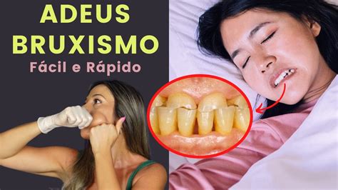 Tratamento Caseiro Para BRUXISMO Pare De APERTAR Os DENTES YouTube