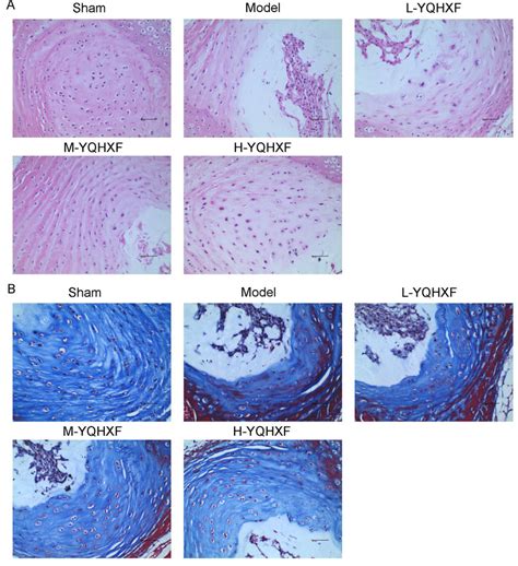 Iqhxf Improved Intervertebral Disc Degeneration In Rat Punctured Ivdd