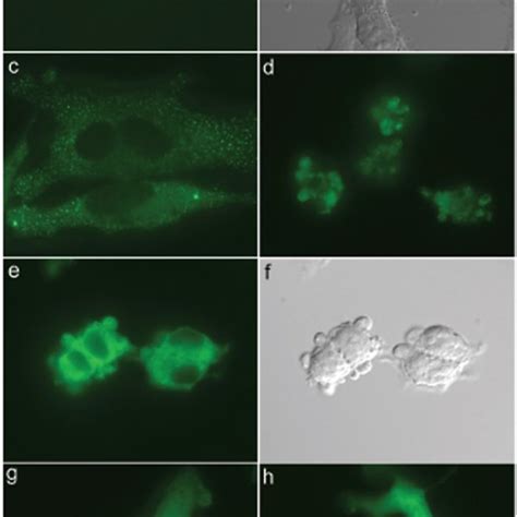 Egfp Tagged 2dedpluse An Engineered Fadd Forms Artificial Discs That