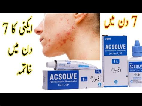 Acsolve Lotion Gel Review How To Treat Acne Acsolve Lotion Acne