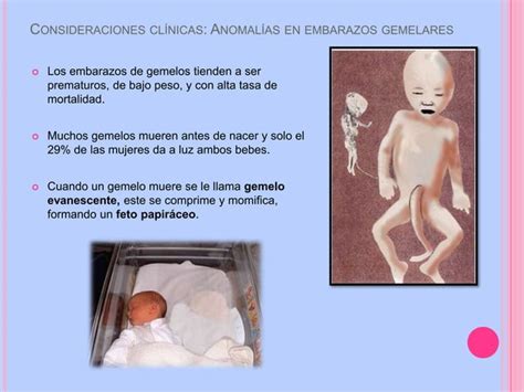 Del Tercer Al Nacimiento El Feto Y La Placenta PPT