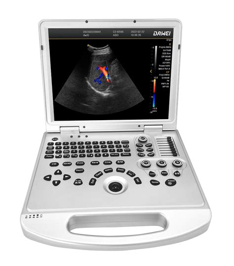 Dawei Dw L D D Portable Ultrasound Color Doppler And Ob Ultrasound