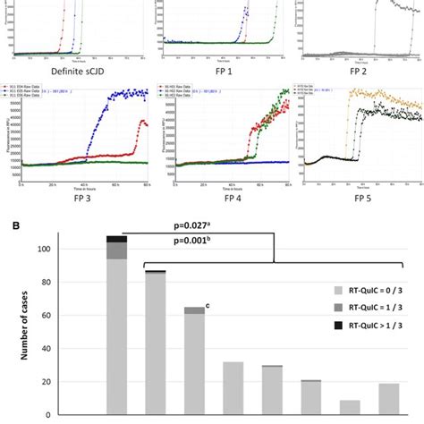 False Positive Csf Rt Quic Fluorescence Signals In Control Patients A