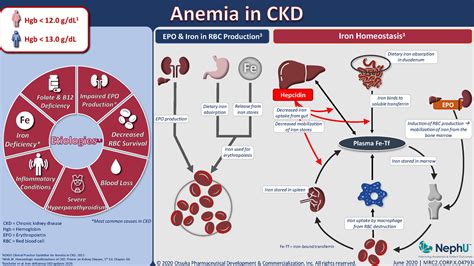 Anemia In CKD - NephU