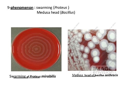 Identification Of Bacteria Depend On 1 Microscopic Appearance