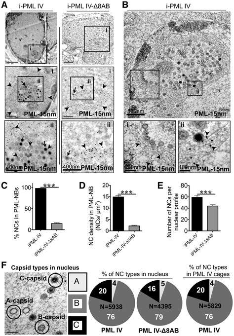 Quantitative Ultrastructural Analysis Of PML IV Cages With Entrapped