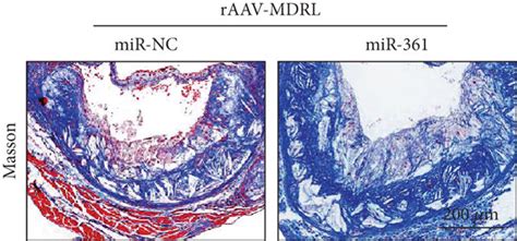 Overexpression Of Mir Counteracts The Protective Effect Of Mdrl