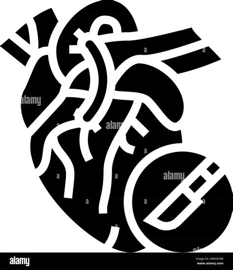 Heart Bypass Surgery Glyph Icon Vector Illustration Stock Vector Image And Art Alamy