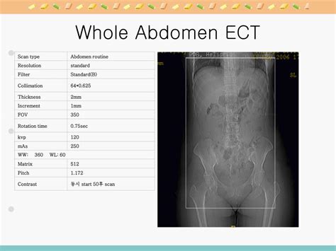 Ppt Abdomen Ct 의 Protocol 과 임상증례 Powerpoint Presentation Id 6355738