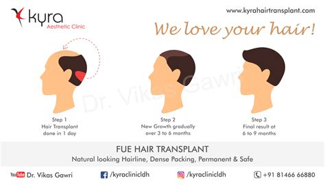 Fue Hair Transplant Cosmetic Surgery In Ludhiana Plastic Surgery In