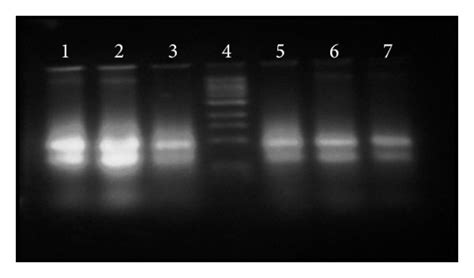 Bands Of Total Rna On 3 Denaturing Agarose Gel Lanes 1 2 And 3 Show Download Scientific