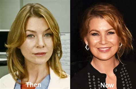 Ellen Pompeo Plastic Surgery Before and After Photos