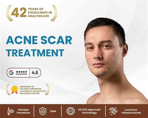 Best Acne Scars Treatment In Gurgaon Acne Scar Treatment Cost