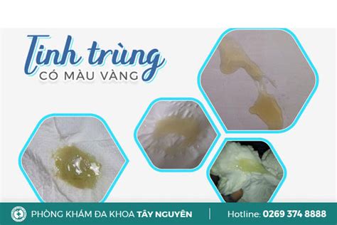 Nguyên nhân tinh trùng màu vàng và hướng điều trị