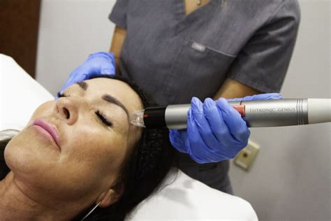 Rf Microneedling Stadia Med Spa