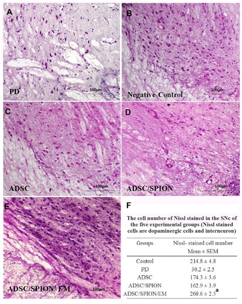 Images Of Hematoxylin And Eosin H E Staining Of Brain Sections In