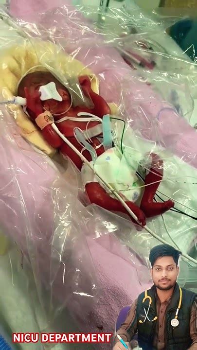 Sort Youtube Viral Reels Nicu Cute Baby Nicu Youtube
