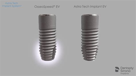 Astra Tech Implant Ev Youtube