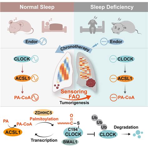 Oncogenic Fatty Acid Oxidation Senses Circadian Disruption In Sleep