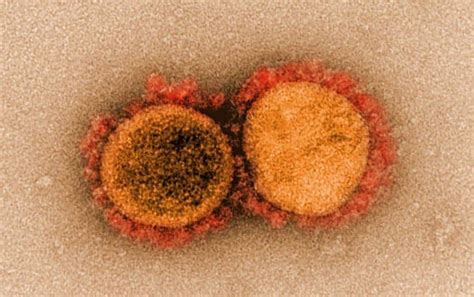 Sangre De Personas Que Se Recuperan Del Coronavirus Podr A Proporcionar