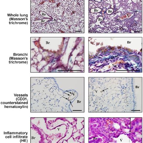 Representative Histological Analysis Of Adult Lung Tissue Showing Download Scientific Diagram