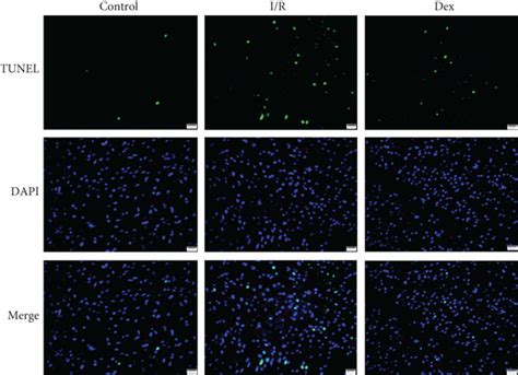 Myocardial Infarct Size And Cardiomyocyte Apoptosis In I R Rats A