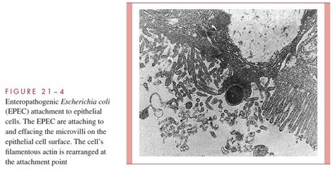 Enteropathogenic E Coli Epec