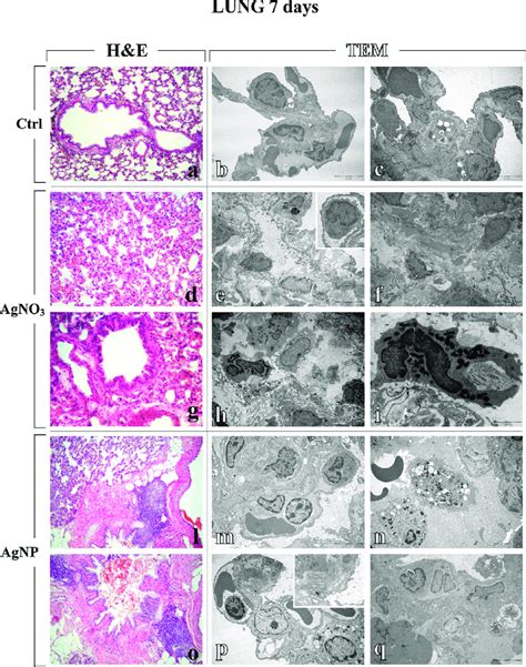 Representative Lung Parenchyma Specimens Investigated By Both Light