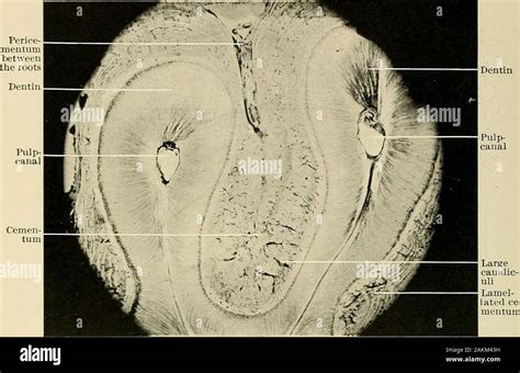 Principles And Practice Of Operative Dentistry Fig 605—vertical