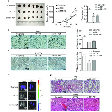 Ttn And Lncrna Ttn As1 Promoted Skcm Tumor Growth And Metastasis In