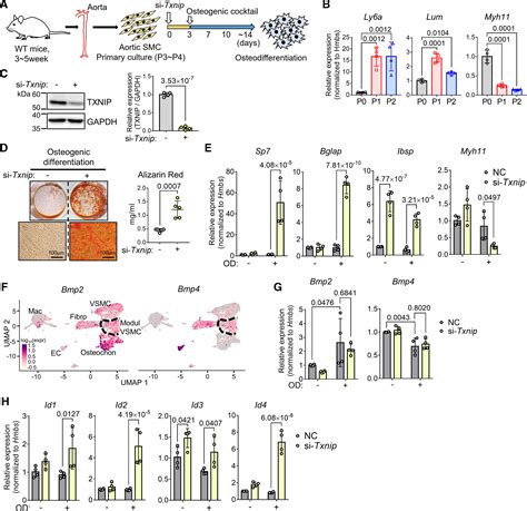 Txnip Suppresses The Osteochondrogenic Switch Of Vascular Smooth Muscle