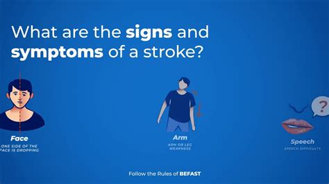 Brain Stroke Types Of Strokes Risk Factors Signs And Symptoms Anu