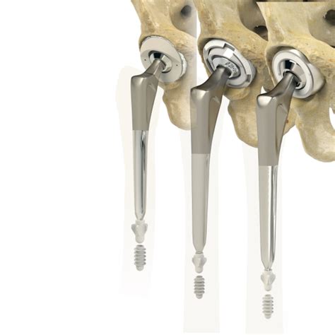 Femoral Stem Cemented Hip Replacement Hip Joint Prostheses Zimed