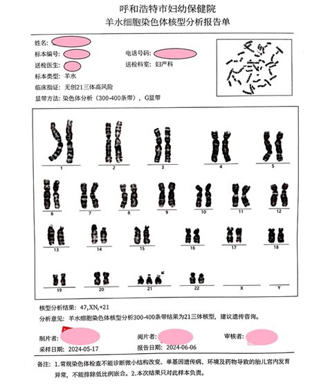 产前诊断精准出击呼市妇幼保健院首例，筛查并诊断21三体综合征检测染色体胎儿