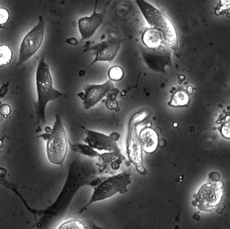 Dynamic Live Apoptotic Cell Assay Using Phase Contrast Imaging And Deep