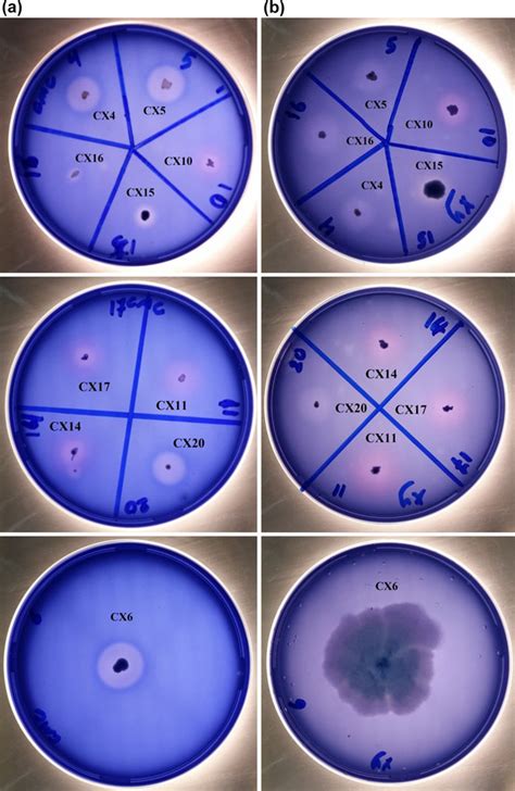 Qualitative Screening Of Cellulolytic And Xylanolytic Bacteria Using A