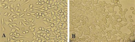 It Has Shown Morphology Of Sh Sy Y Human Neuroblastoma Cell In The