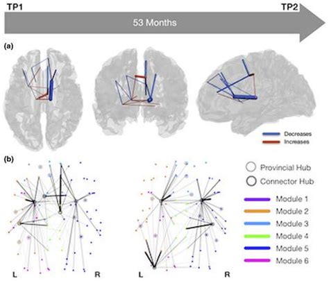 Reorganization Of Brain Structural Networks In Aging A Longitudinal