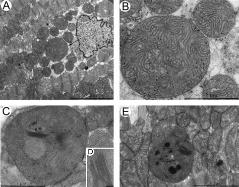 Electron Microscopy Observations Of Mitochondria In The Naked Mole Rat