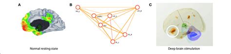 A The Brains Default Mode Network Is A Steady State Circuit Of The Download Scientific