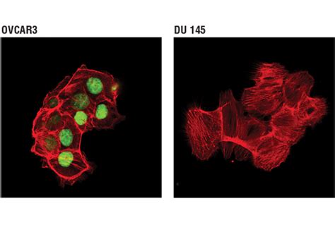 Wt1 Transcription Factor Antibodies